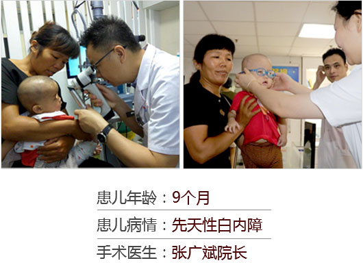 患儿年龄：9个月，患儿病情：先天性白内障，手术医生：张广斌院长